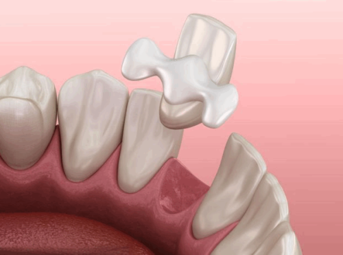 四、熬夜后拔牙会不会止不住血