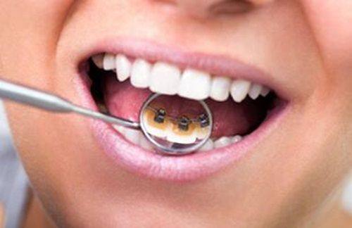 三、拔牙引起干燥症症状——学会区分正常反应与异常信号