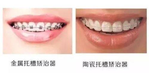 杨笑草医生技术优势