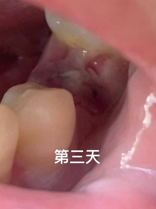 南京宋培栋口腔诊所价格表