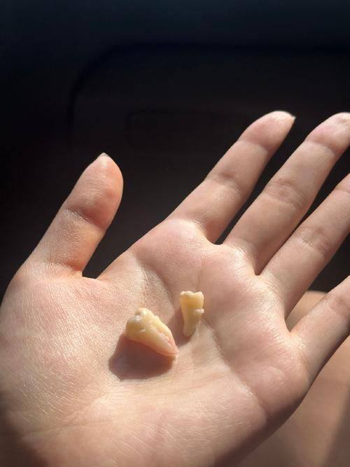 上海华驰口腔门诊部口碑评价：