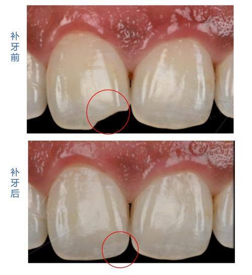 上海华驰口腔门诊部擅长项目：