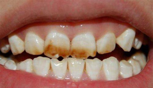 五、低压100可以做手术吗？和拔牙的风险逻辑一致