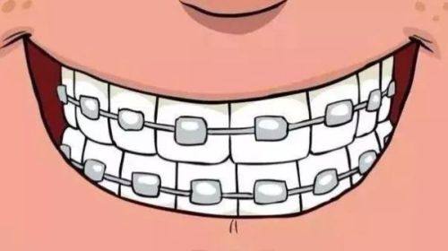 四、五十岁洗牙后的常见反应及应对技巧