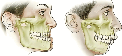 三、五十岁后如何选择适合自己的洗牙频率
