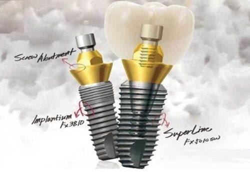 五、进口自锁金属托槽矫正的费用影响因素