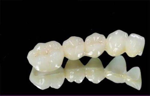 山东泰安新泰巩键口腔擅长项目：