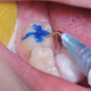 成都武侯英博口腔价格表: