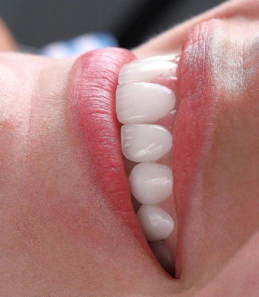 二、低压100拔牙会怎么样？风险要提前知晓