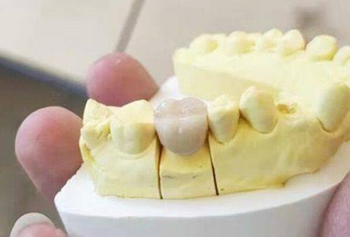 三、隐形矫正拔牙的原则与安心性