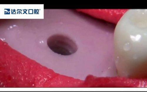 昆山皓齿口腔医生名单及擅长领域：