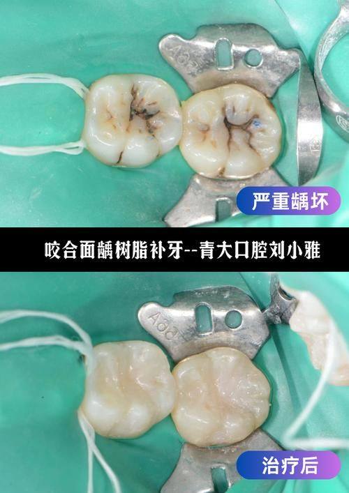 长沙齿邦口腔连锁(瑞智店)医生名单及擅长领域: