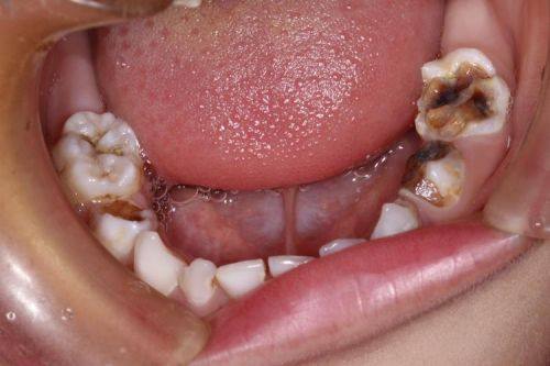 宜丰高品口腔预约挂号方式: