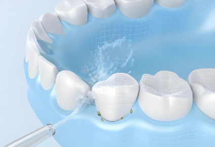 二、1-5年售后质保：这些情况能免费换