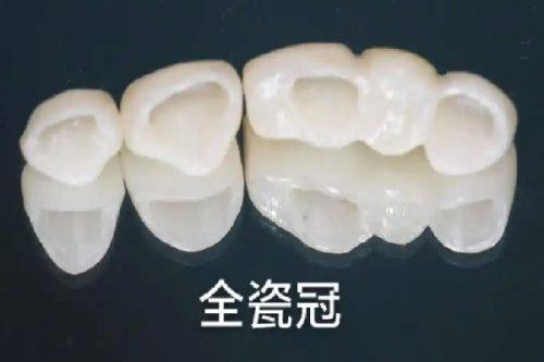 四、儿童地包天重度程度的特殊判断要点