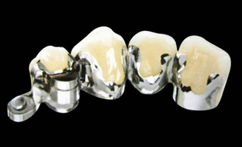 广州笑果引力牙齿矫正中 心预约挂号方式: