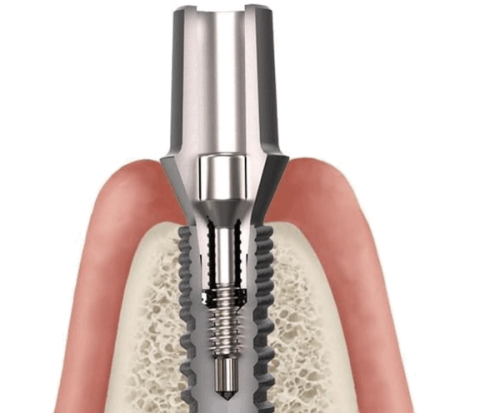 五、治疗后轻微不适的正常化认知