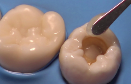 广州笑果引力牙齿矫正中 心地址电话及营业时间: