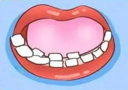 五、坚持一年洗牙一次，如何配合日常口腔护理