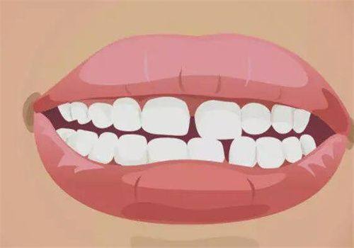 影响根管治疗时长的关键因素