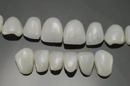 四、牙冠收费标准与影响因素