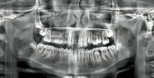 五、其他地区补牙挂号及就诊提示