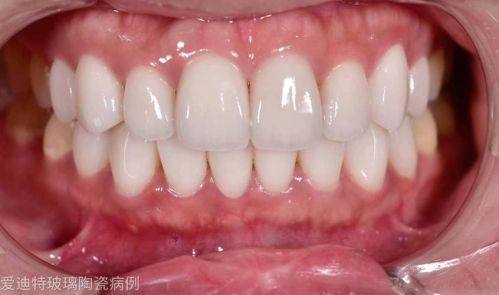 贵州铜仁松桃外滩麦芽口腔怎么样？