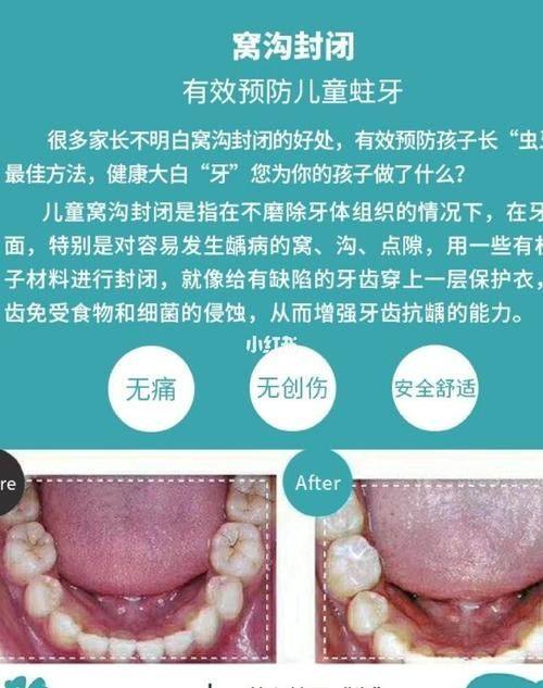 山东泰安丽丽口腔诊所擅长项目: