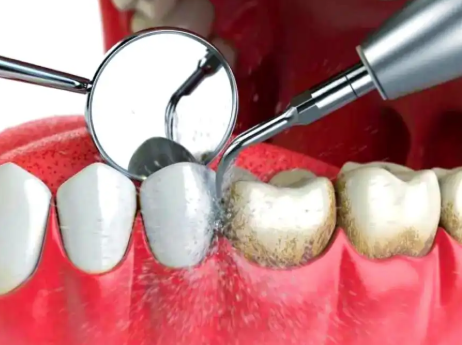 三、种植项目简介范文（以植发+种植牙综合门诊项目为例）