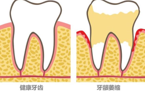 四、影响烤瓷牙价位的核心因素
