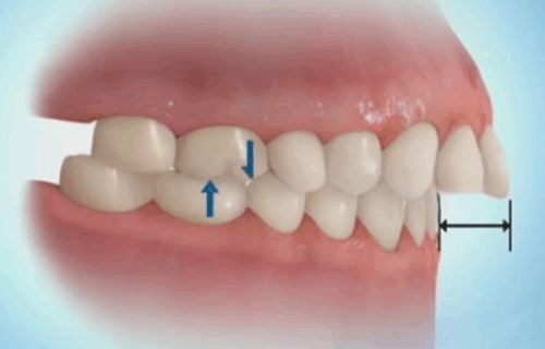 六、及时就医,精细解决长期酸痛