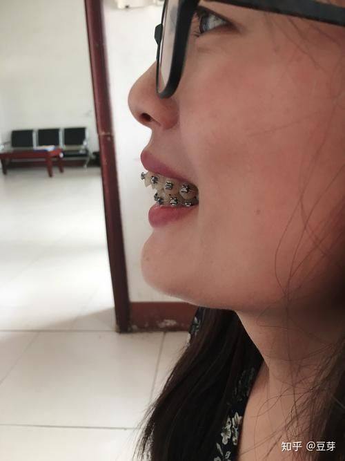 微笑青澄口腔门诊部地址电话及营业时间: