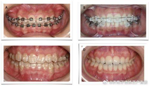 微笑青澄口腔门诊部口碑评价: