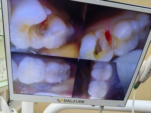 东莞洁雅口腔门诊部地址电话及营业时间：