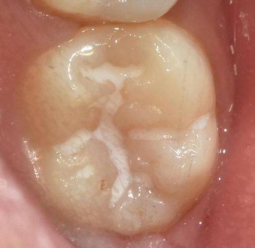 东莞洁雅口腔门诊部怎么样？