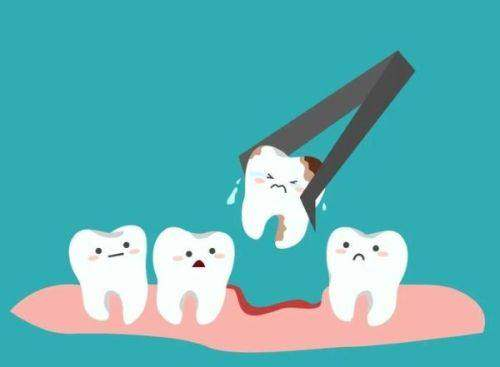 四、洗牙三个月酸痛要不要吃药?别盲目用药