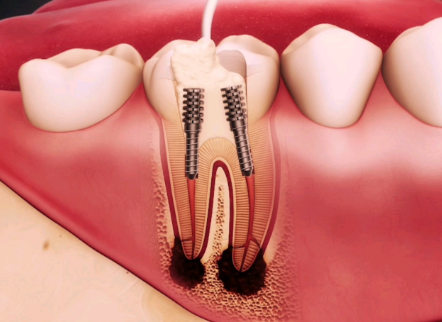 东莞洁雅口腔门诊部擅长项目：