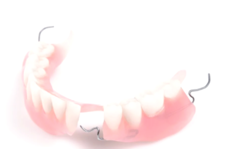 四、关于根管治疗的常见误区要认清