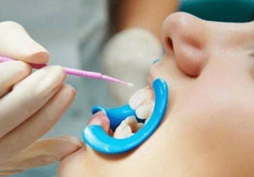 四、糖尿病患者拔牙后的注意事项