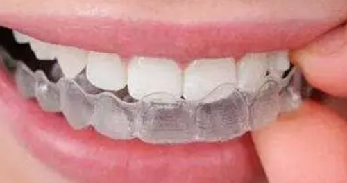 四、PTA洗牙：高频振动技术，更省时的深度清洁