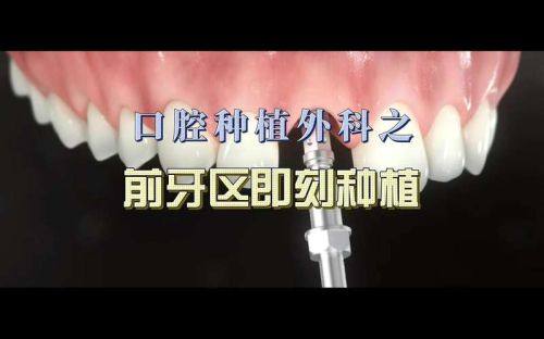 昆明市口腔医院口腔种植科地址电话及营业时间