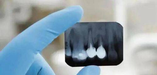 昆明市口腔医院口腔种植科价格表