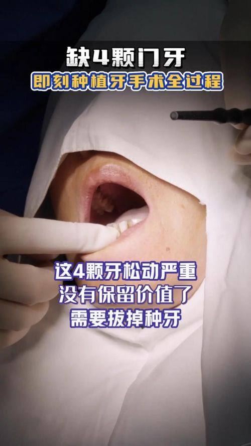 昆明市口腔医院口腔种植科预约挂号方式