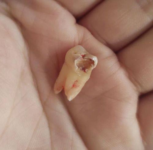 渭南蒲城翼道康口腔诊所价格表：