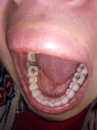 渭南蒲城翼道康口腔诊所口碑评价：