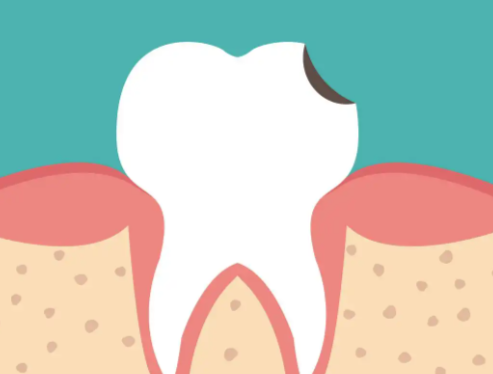 五、口腔状况良好：洗牙时长更紧凑，20-30分钟即可完成
