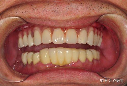 盐城通植口腔医生名单及擅长领域：