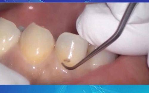 盐城通植口腔怎么样？