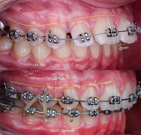 江苏镇江大港一佳口腔诊所怎么样？