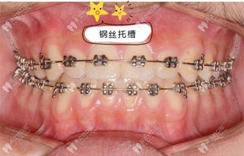 湖南长沙普希口腔怎么样？